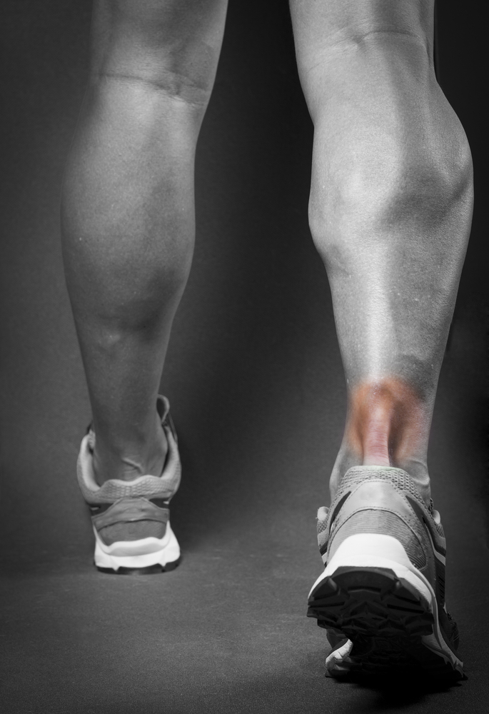 Calf Muscle Injuries — Brookvale Physio