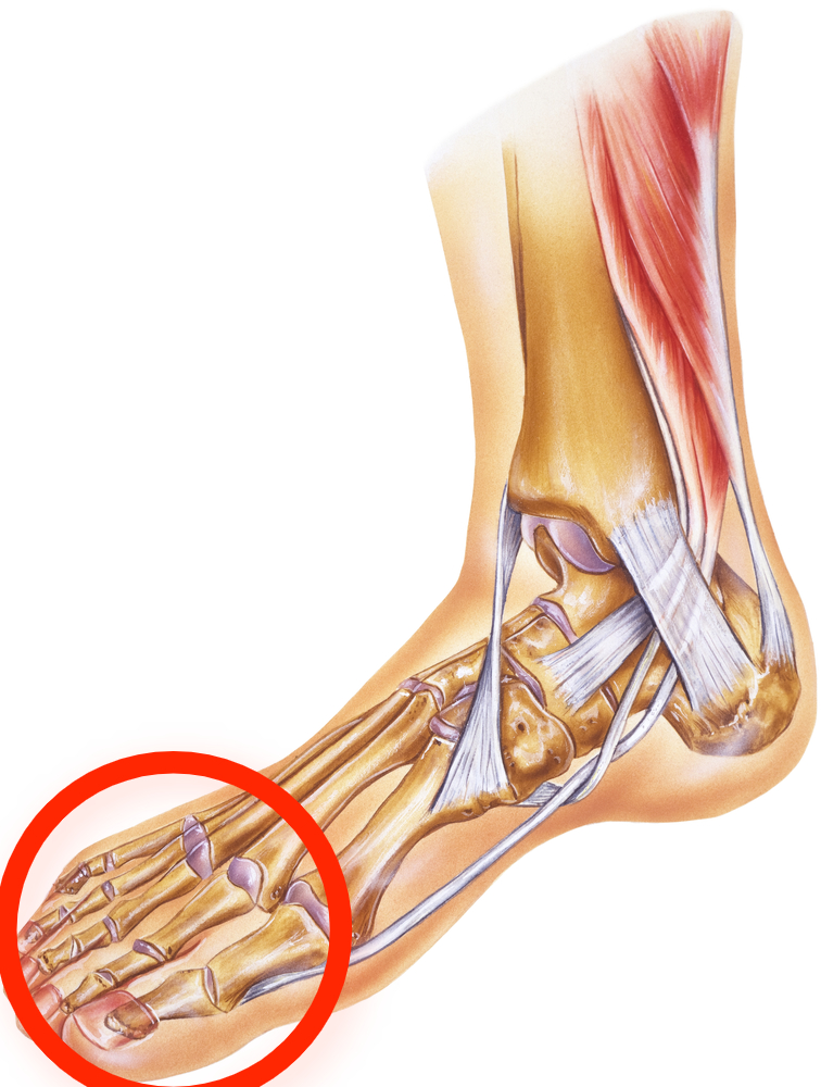 plantar midfoot pain