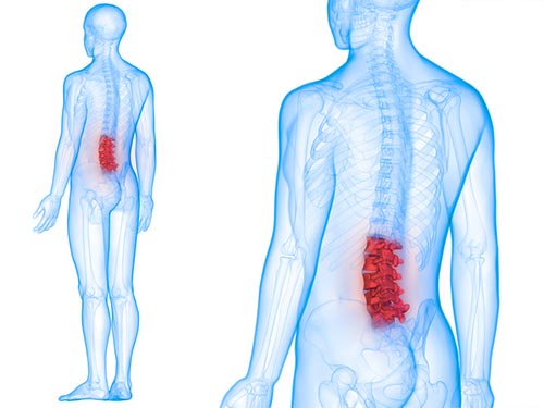 Pain in the lumbar spine